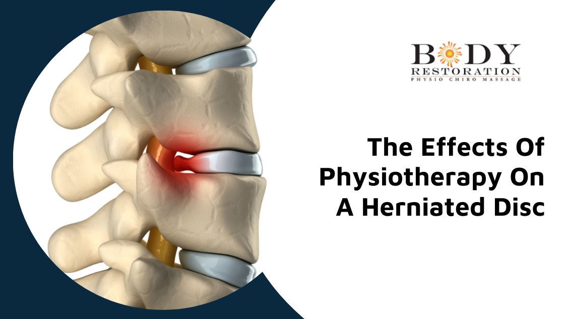 Physiotherapy for herniated disc edmonton south